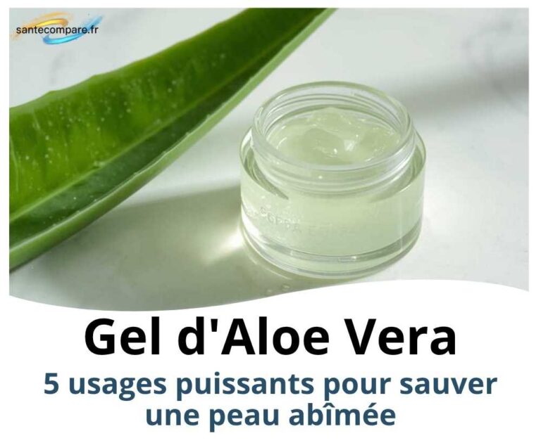 Gel d'Aloe Vera 5 usages puissants pour sauver une peau abîmée